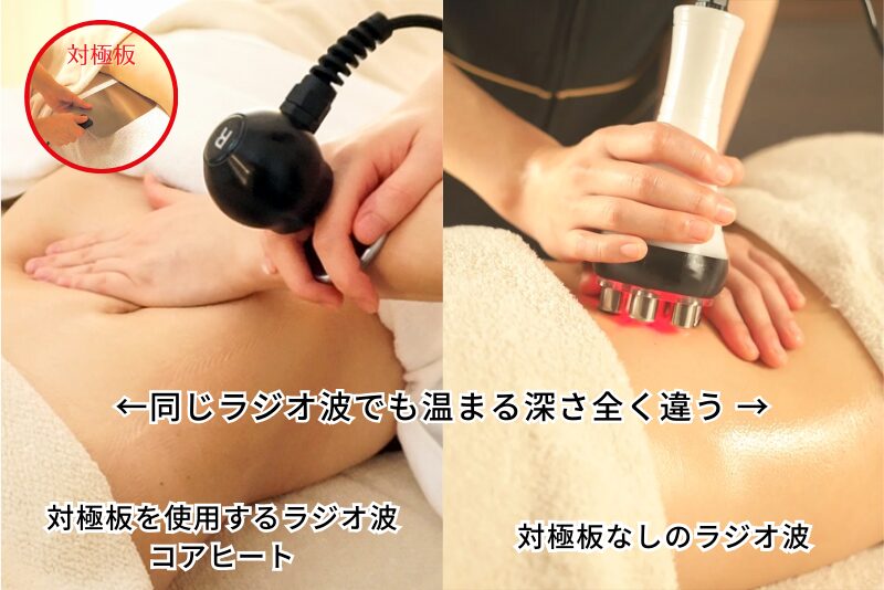 同じラジオ波でも温まる深さ全く違う 