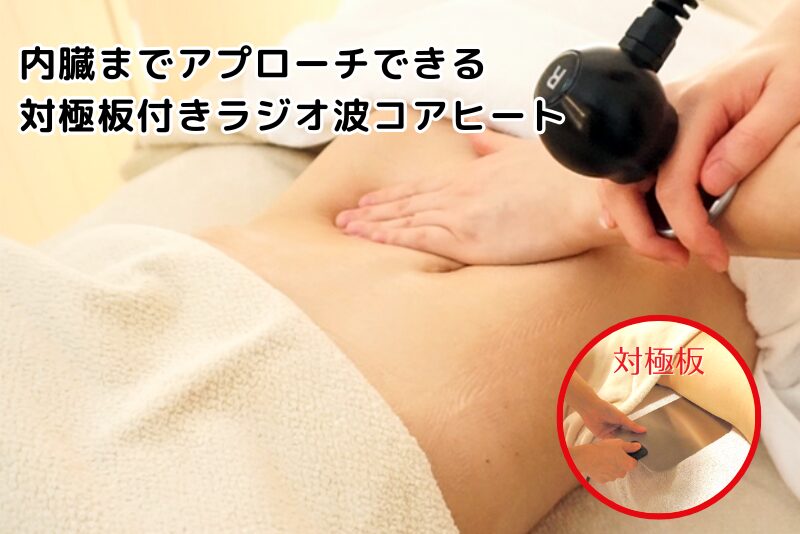 内臓までアプローチできる対極板付きラジオ波コアヒート