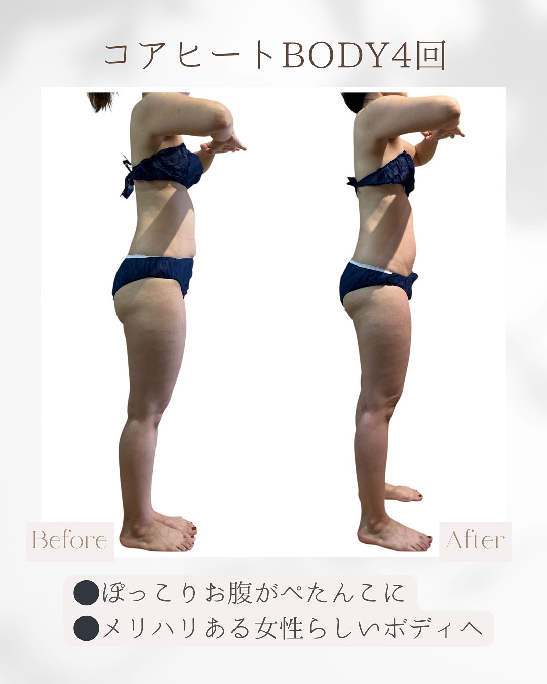 ラジオ波コアヒート痩身のお客様結果写真