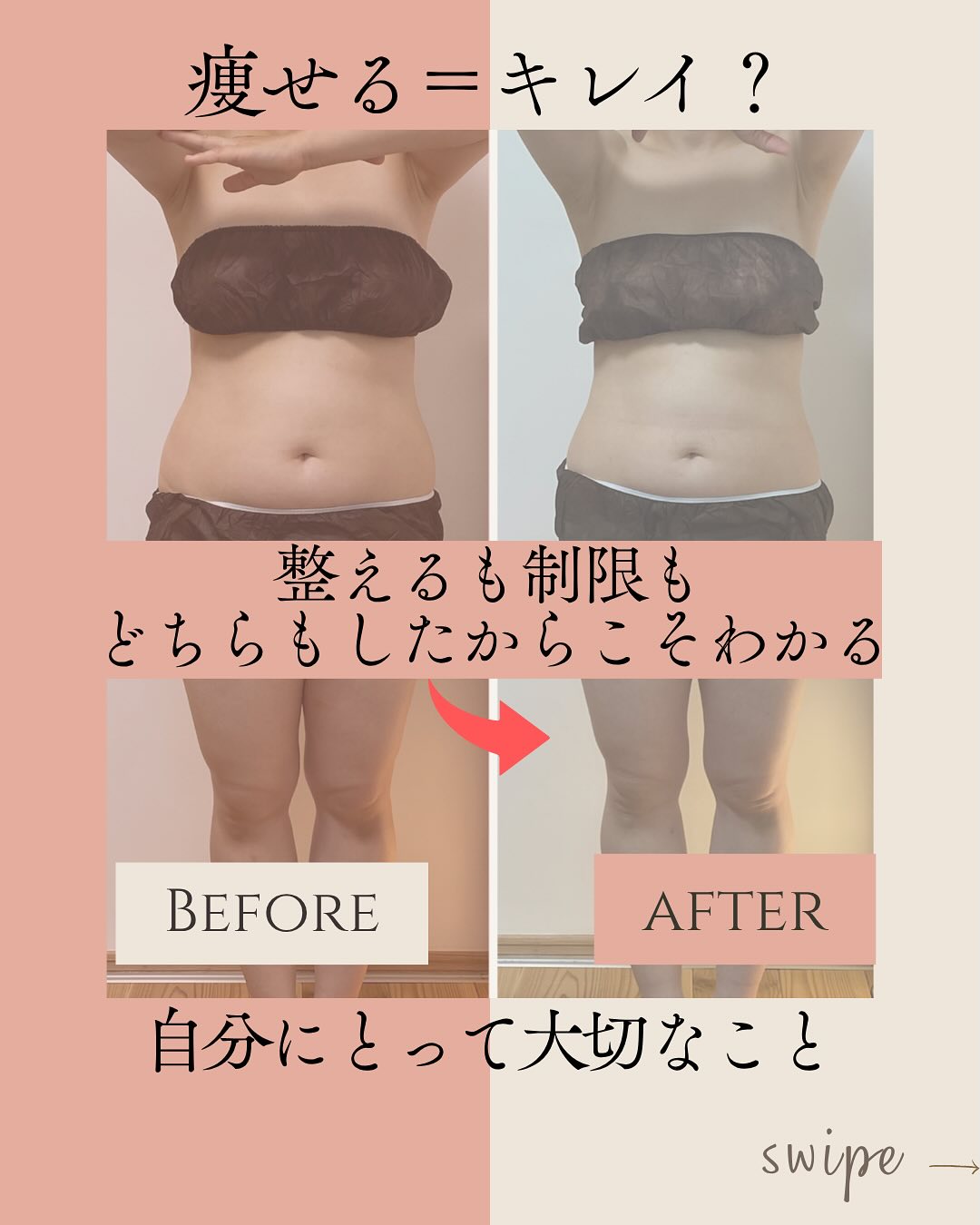 ラジオ波コアヒート痩身のお客様結果写真