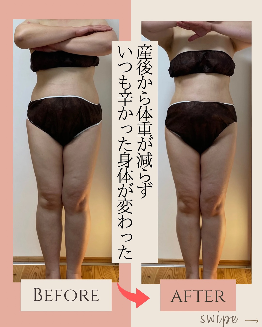 ラジオ波コアヒート痩身のお客様結果写真