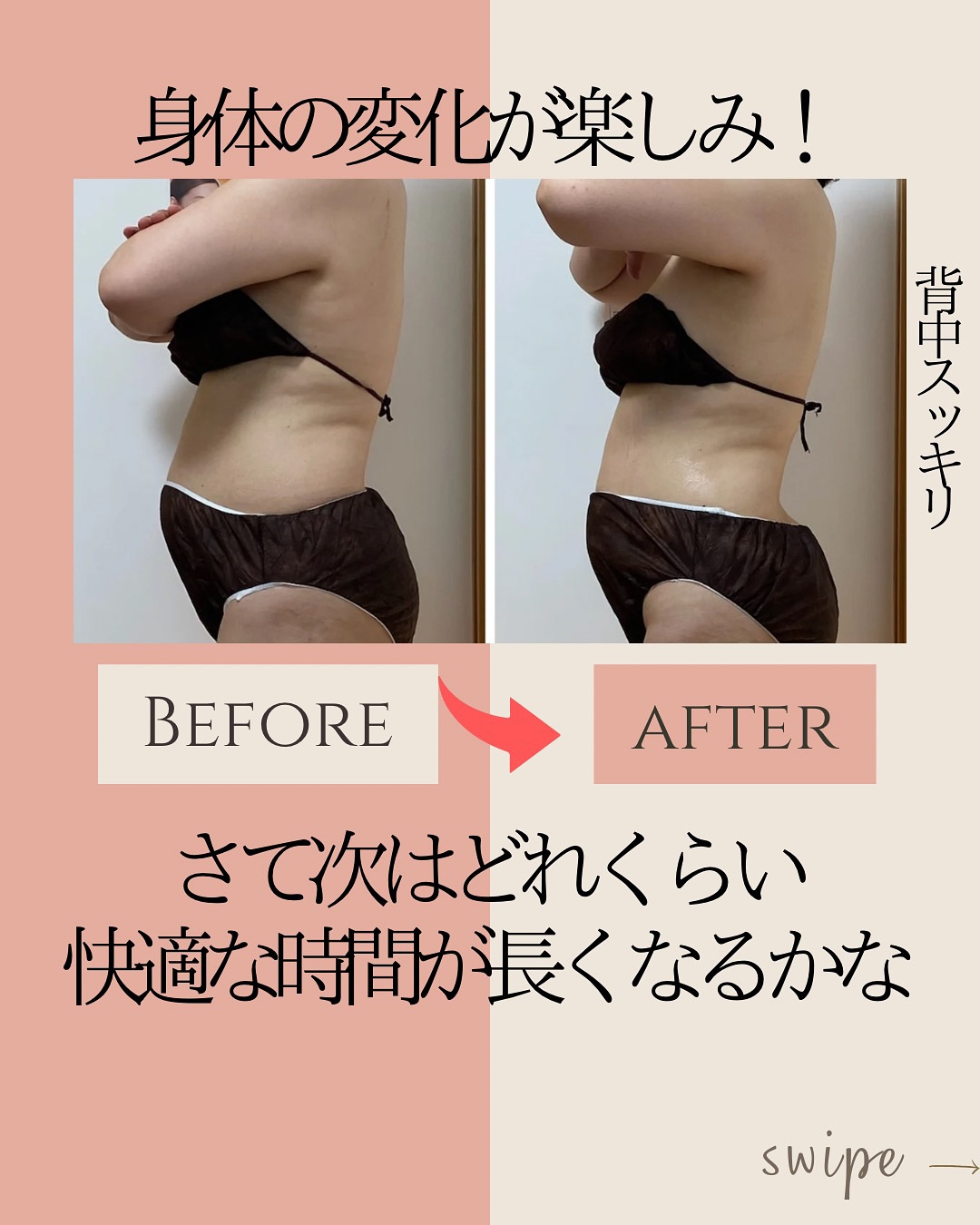 ラジオ波コアヒート痩身のお客様結果写真