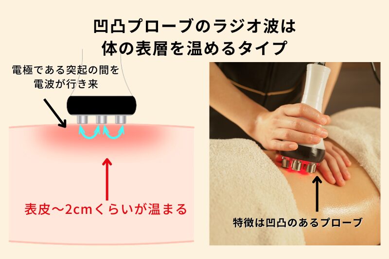 凹凸プローブのラジオ波は
体の表層を温めるタイプ